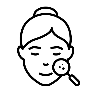 ニキビ治療