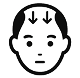男性AGA