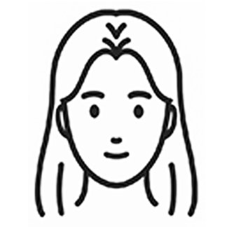 女性AGA