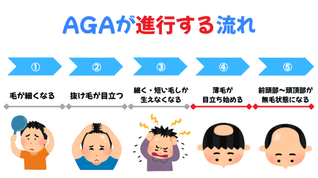 AGAが進行する流れ