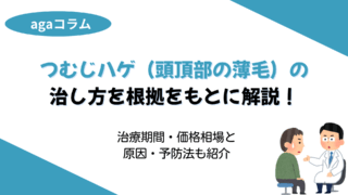 つむじはげ 治し方