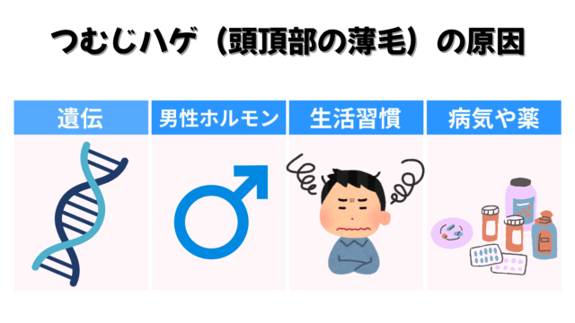 つむじハゲ(頭頂部の薄毛)の原因