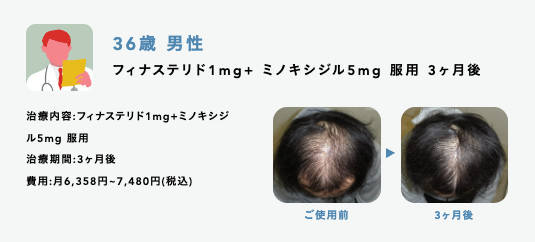 症例紹介