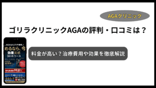 ゴリラクリニック AGA 評判