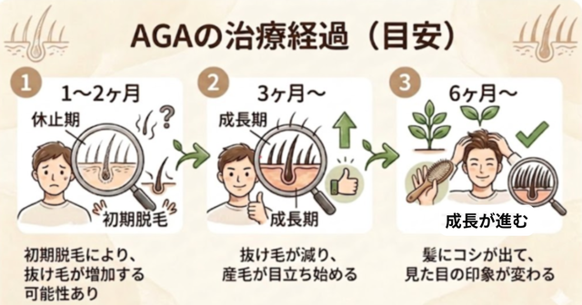 aga,福岡,おすすめ_AGAの治療経過‗治療継続と目安