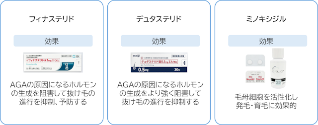 AGA　治療薬　効果