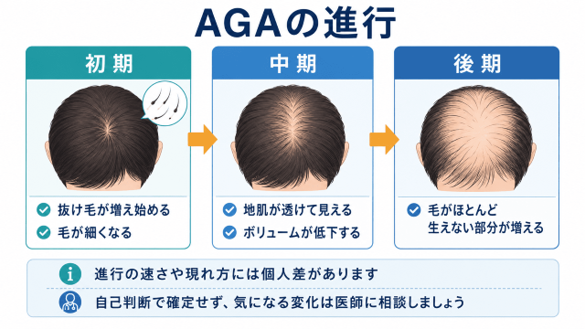 AGAの進行
