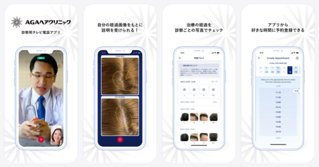 AGAヘアクリニック_iOSアプリ