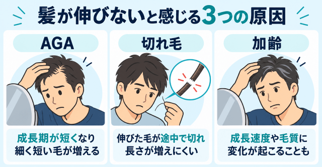AGA・切れ毛・加齢の違い 図解