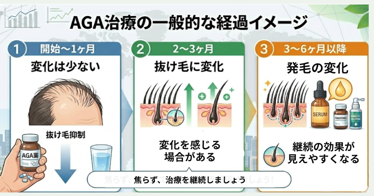 aga,梅田,おすすめ_AGA治療の経過イメージ