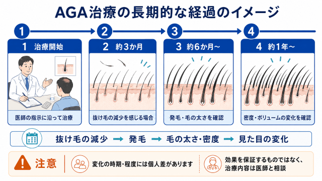AGA治療の長期的な経過のイメージ