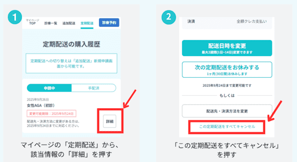DMMオンラインクリニックAGAの定期便解約
