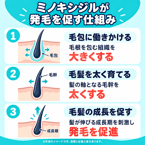 DMMオンラインクリニック,ミノキシジルの効果