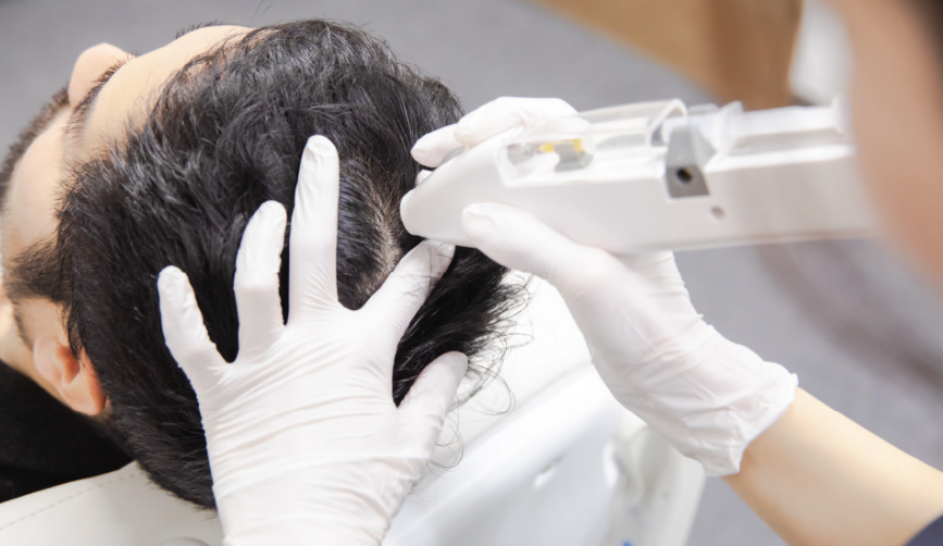 Dr.AGAクリニック 超発毛メソ治療