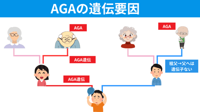 ハゲたくない「aga 遺伝」