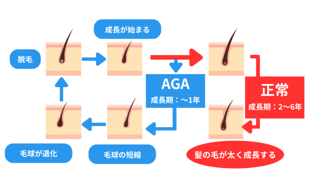 髪を濡らすと頭皮が見える「AGAのメカニズム」