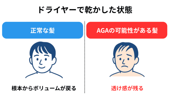 髪を濡らすと頭皮が見える「髪を乾かした状態で頭皮が透けていないかを確認する」