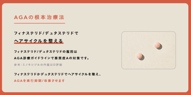 Oops_AGA治療