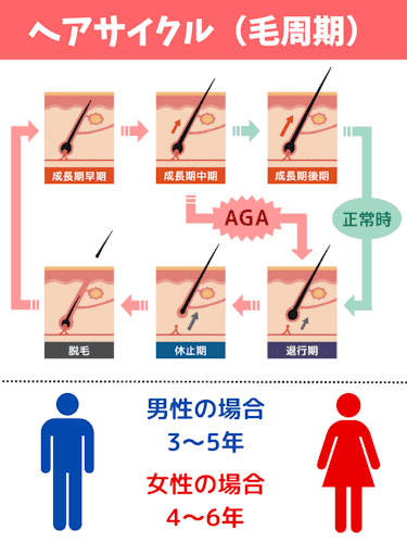 aga,女性,おすすめ,ヘアサイクル