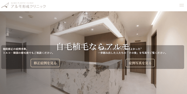 aga,秋葉原,おすすめ,アルモ形成クリニック