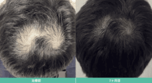 dgaクリニック症例①