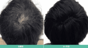 dgaクリニック症例②