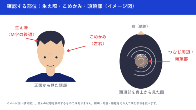 確認する部位（生え際・こめかみ・頭頂部）