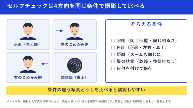 セルフチェックは4方向を同じ条件で撮影して比べる