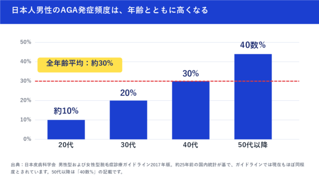 日本人男性のAGA発症頻度は、年齢とともに高くなる