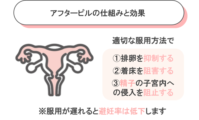 アフターピル 避妊と仕組みと効果