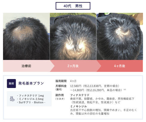 クリニックフォアの治療写真