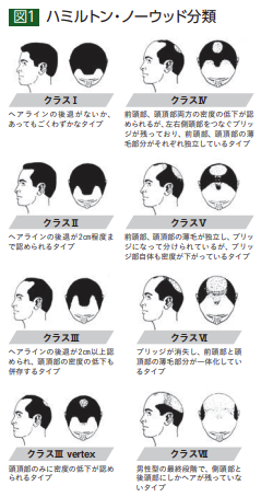 ハミルトン・ノーウッド分類