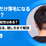 後頭部だけ薄毛 原因は AGA 可能性 原因 対処法 隠し方 解説