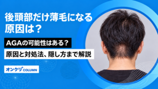 後頭部だけ薄毛 原因は AGA 可能性 原因 対処法 隠し方 解説