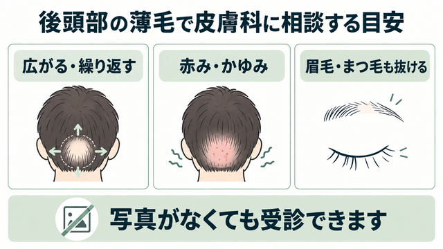 後頭部だけ薄毛 受診 ケース