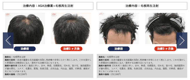 湘南AGAクリニック池袋院,症例