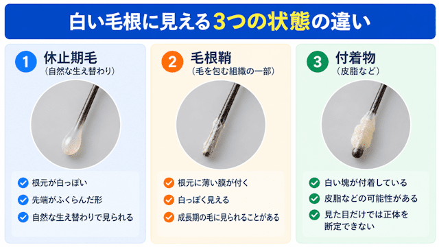 白い毛根に見える3つの状態の違い