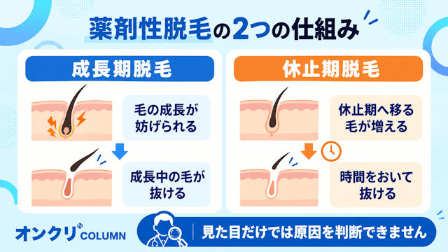 薬剤性脱毛の成長期脱毛と休止期脱毛の仕組みを比較